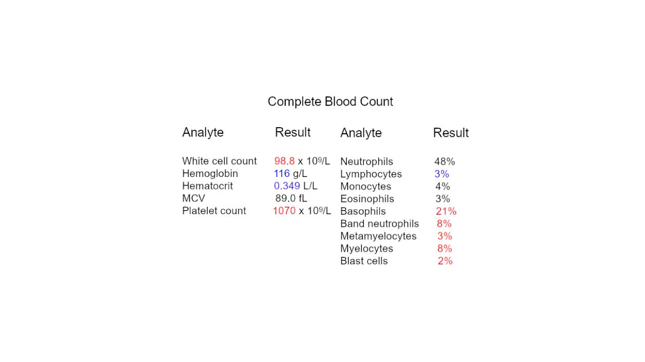 Leukocytosis: Types, Causes, Symptoms, Complications & Treatment