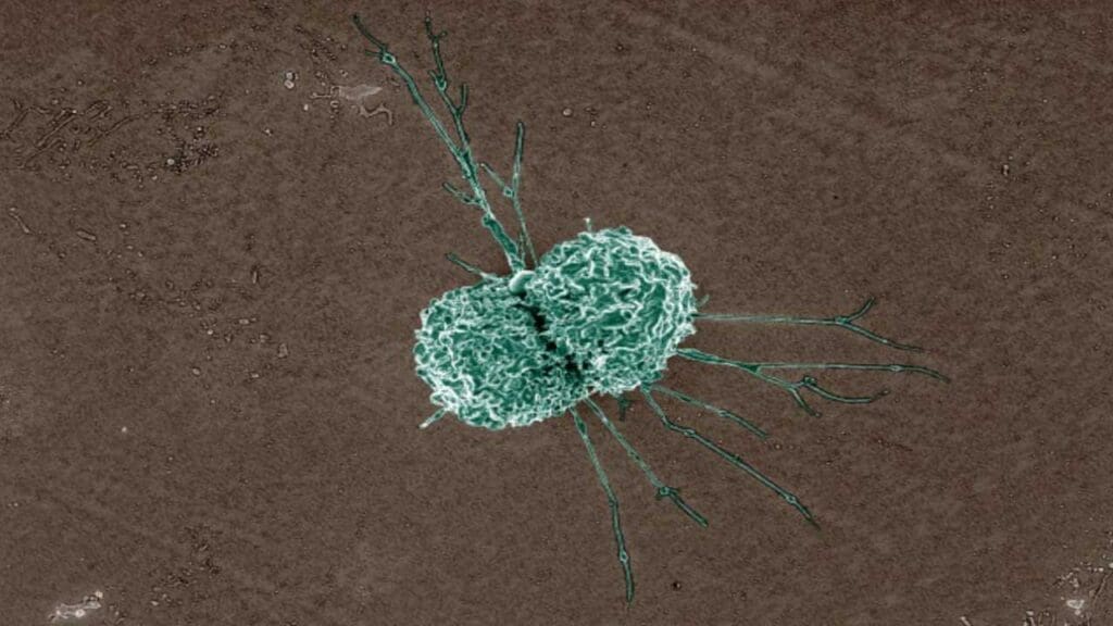 A scanning electron micrograph of a macrophage