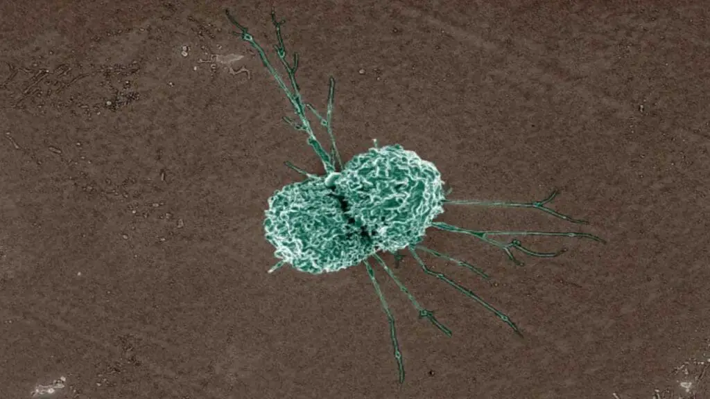 Electron micrograph of a tissue macrophage. 