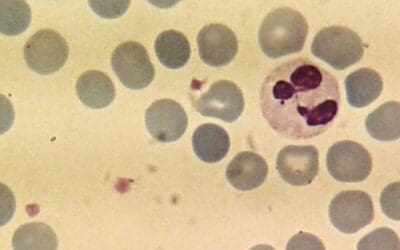 Neutrophils