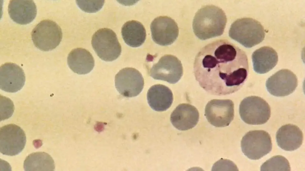 Neutrophils: Function, High and Low Neutrophils Count