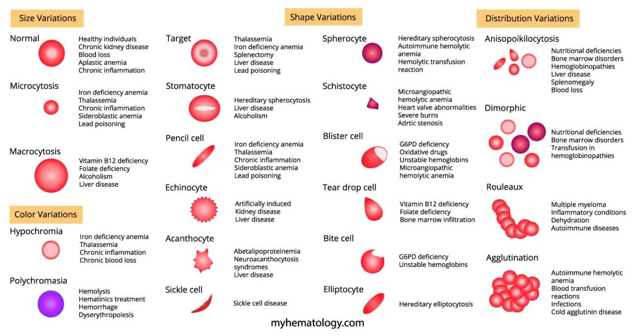 Abnormal Red Blood Cell Morphology: Causes & Interpretation