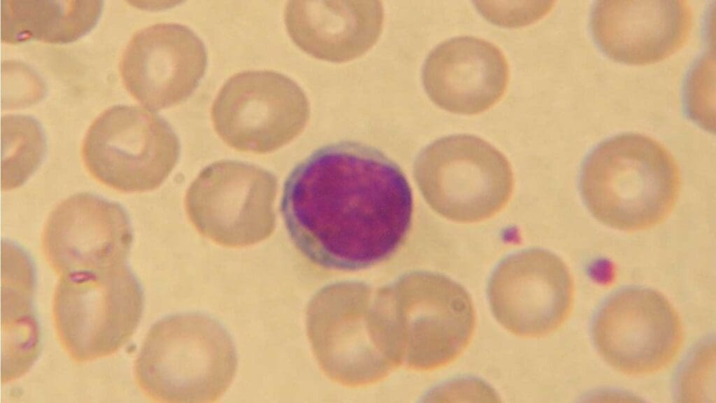 A small lymphocyte in the peripheral blood smear.