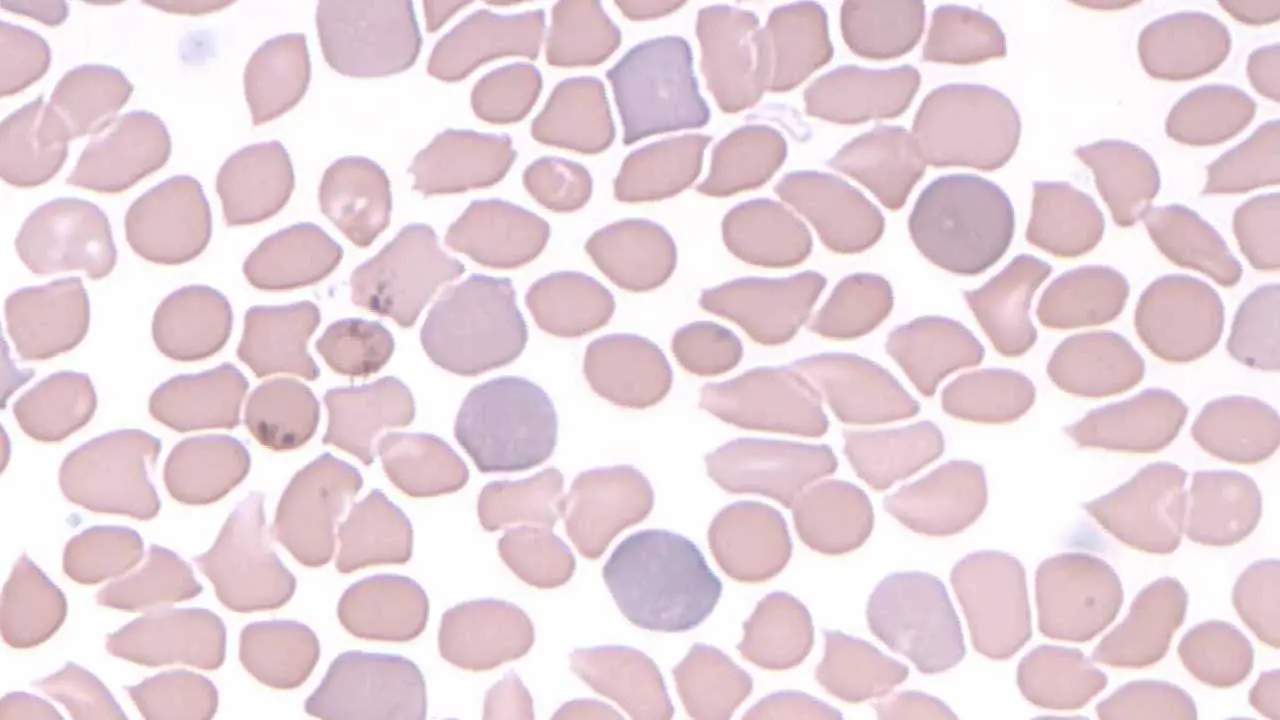 Polychromatic red cells or polychromasia are immature red cells known as reticulocytes. They are larger and stain with a bluish hue compared to mature red cells. 