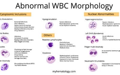 Abnormal WBC (White Blood Cell) Morphology