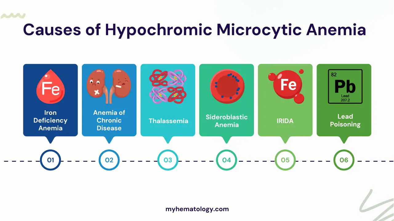 Causes of hypochromic microcytic anemia include iron deficiency anemia, anemia of chronic disease, thalassemia, sideroblastic anemia, IRIDA and lead poisoning.