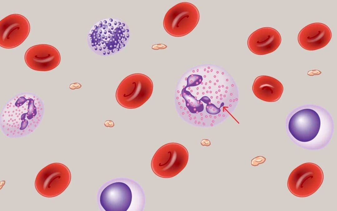 Abnormal White Blood Cell Morphology