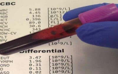 CBC with Differential and Other Reference Ranges