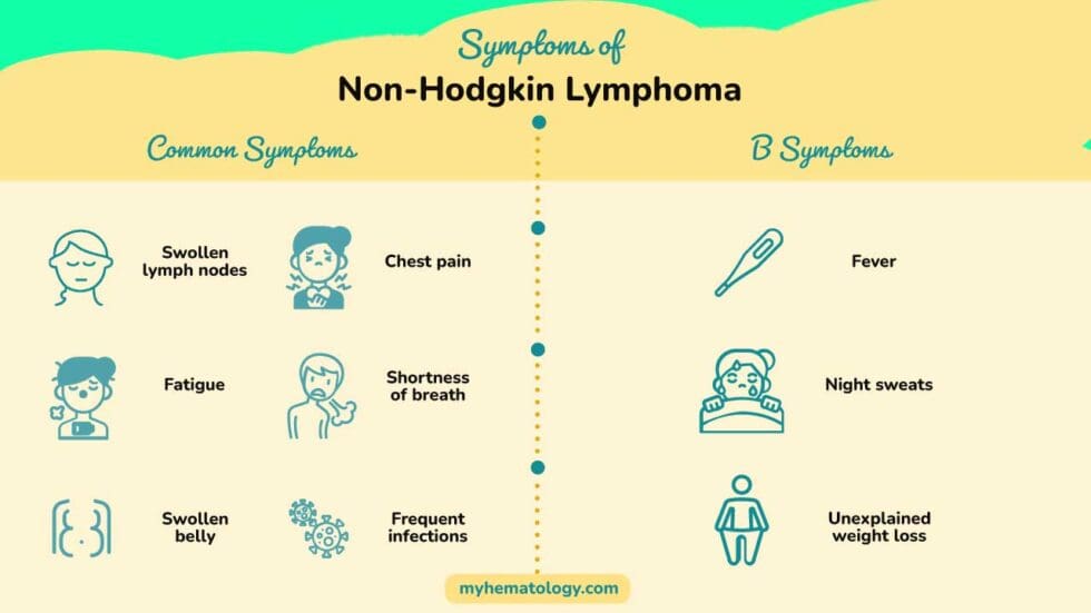 Non-Hodgkin Lymphoma: Symptoms, Diagnosis, Treatment & Subtypes