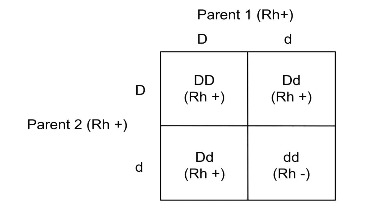 Possible RhD blood group genotypes whereby an offspring has 75% probability of having RhD positive blood type and 25% probability of having Rh negative blood type.