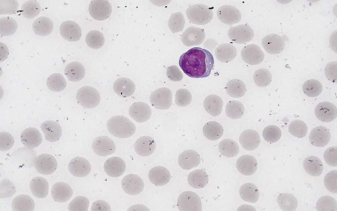 Lymphocytes