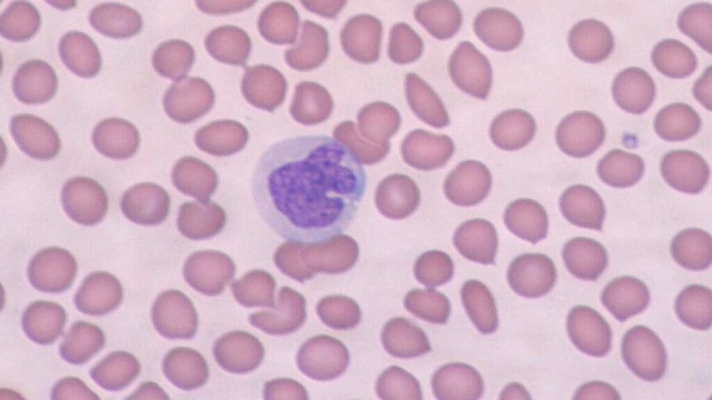 Monocyte in a peripheral blood smear. 