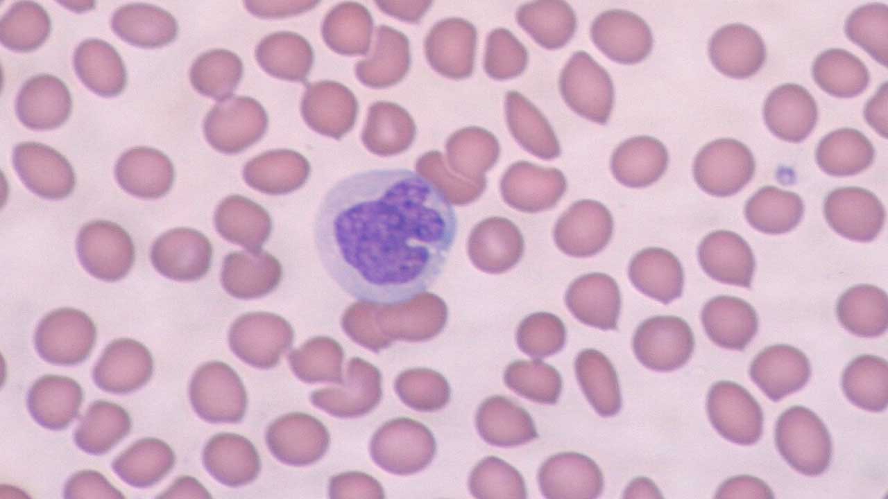 Monocytes: Definition, Function, Causes of High and Low Count