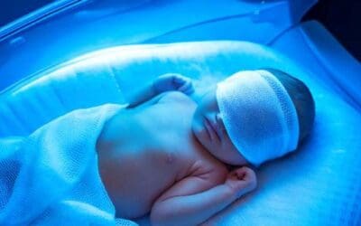 Neonatal Jaundice (High Bilirubin Levels in Newborns)