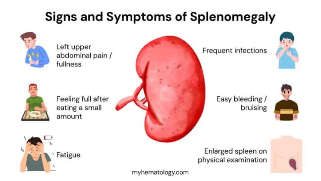 Spleen: Function, Causes of Splenomegaly & Splenic Pain