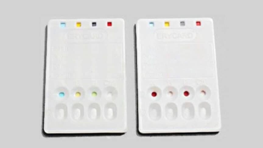 Blood Typing: Exploring Blood Type Tests and Beyond
