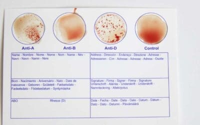 Blood Typing: Exploring Blood Type Tests and Beyond