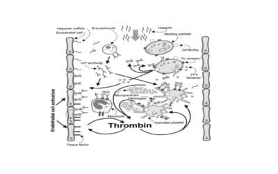 Heparin-Induced Thrombocytopenia