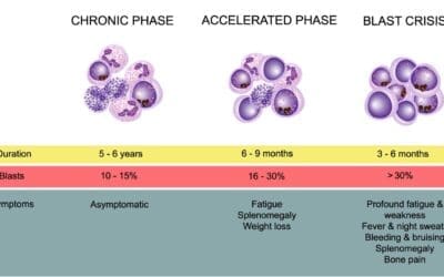 Chronic Myeloid Leukemia Treatment Strategies