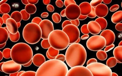 Causes of Polycythemia