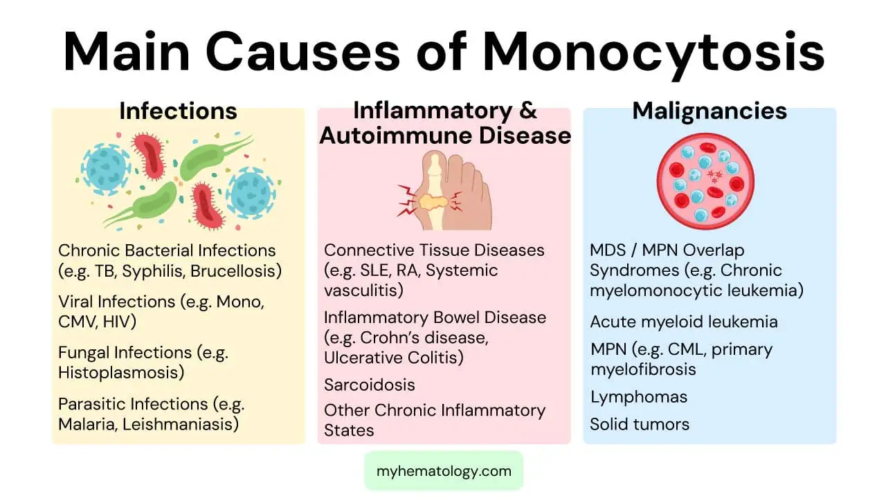 Main causes of monocytosis includes infections, inflammatory & autoimmune diseases and malignancies
