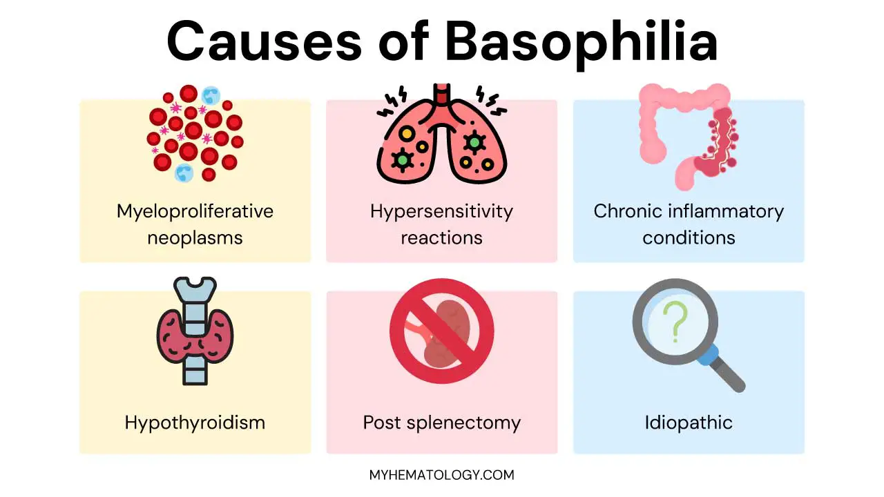 Causes of basophilia include MPNs, allergic & hypersensitivity reactions, chronic inflammatory & infection conditions, hypothroidism, post-splenectomy and idiopathic basophilia