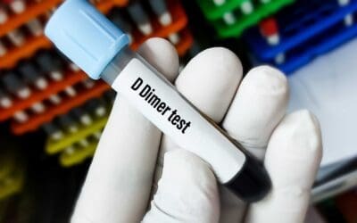 D-Dimer Test
