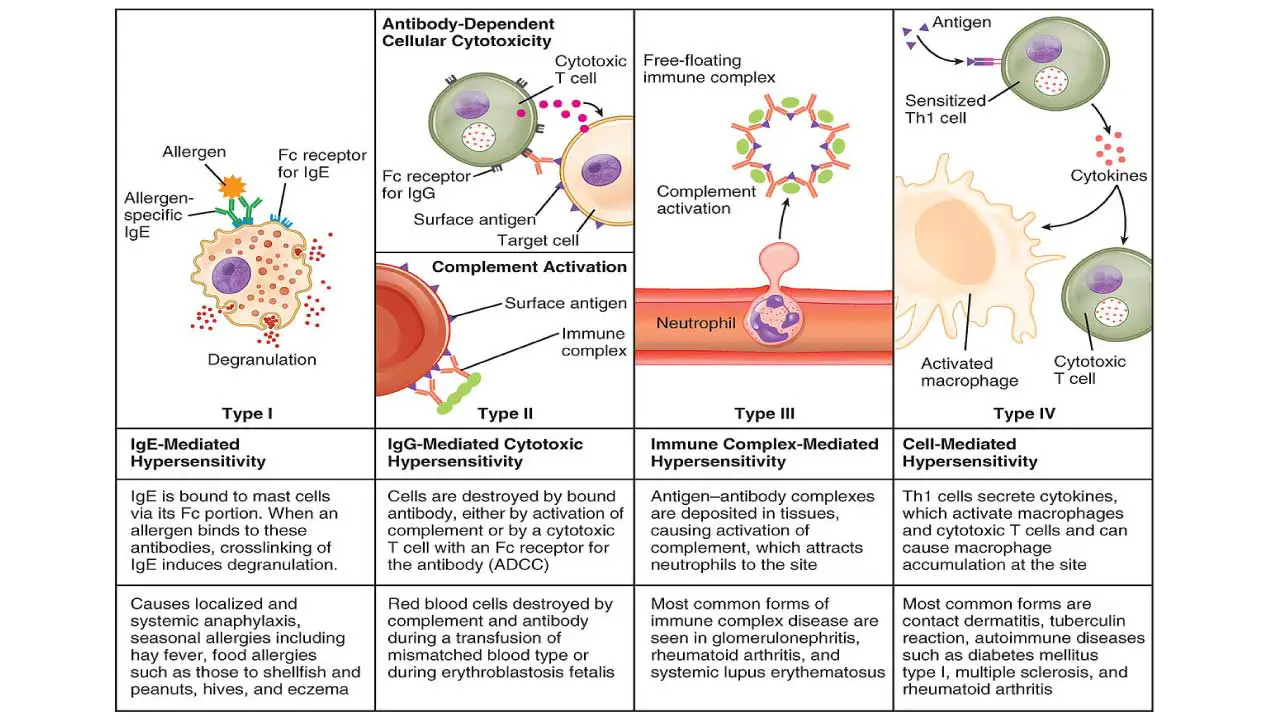 Hypersensitivity reactions are categorized into four distinct types based on their underlying immune mechanisms. Type I hypersensitivity is mediated by IgE antibodies, leading to the activation of mast cells and basophils, which then release potent vasoactive mediators. In contrast, Type II hypersensitivity involves IgG (and sometimes IgM) antibodies that trigger either complement activation or antibody-dependent cellular cytotoxicity (ADCC), resulting in cell damage. Type III hypersensitivity occurs due to the formation of immune complexes, which subsequently induce the classical complement pathway, leading to a significant inflammatory response and a massive infiltration of neutrophils. Finally, Type IV hypersensitivity is primarily mediated by Th1 cells that release cytokines, responsible for activating macrophages and orchestrating a cell-mediated inflammatory response.