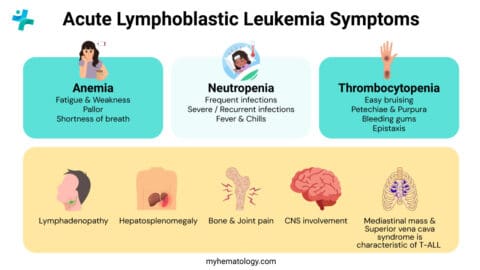 Acute Lymphoblastic Leukemia or ALL: Causes, Symptoms & Treatment