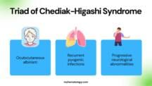 Chediah Fall Chediak-Higashi Syndrome: Causes, Symptoms, Diagnosis & Treatment