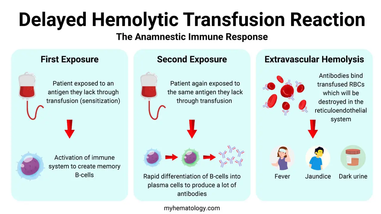 A delayed hemolytic transfusion reaction (DHTR) occurs when a recipient, previously sensitized to a minor red blood cell (RBC) antigen (e.g., from a prior transfusion or pregnancy), receives a transfusion of RBCs carrying that specific antigen. At the time of transfusion, routine antibody screening may be negative as the antibody levels are too low to detect. Upon re-exposure to the antigen-positive RBCs, an anamnestic (secondary) immune response is triggered, leading to rapid proliferation of B cells and plasma cells that produce a surge of IgG antibodies over several days, typically peaking 3-7 days post-transfusion. These newly produced IgG antibodies bind to the circulating transfused RBCs that express the target antigen. The antibody-coated RBCs are then recognized by macrophages, primarily in the spleen, which phagocytize and destroy them in an extravascular hemolysis process. This extravascular destruction leads to signs and symptoms such as fever, anemia, jaundice, and dark urine, typically appearing 7-14 days after the transfusion as the hemolysis becomes clinically significant.