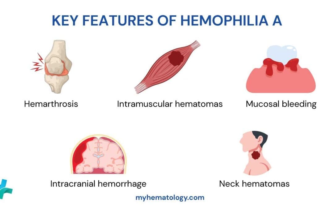 Hemophilia A