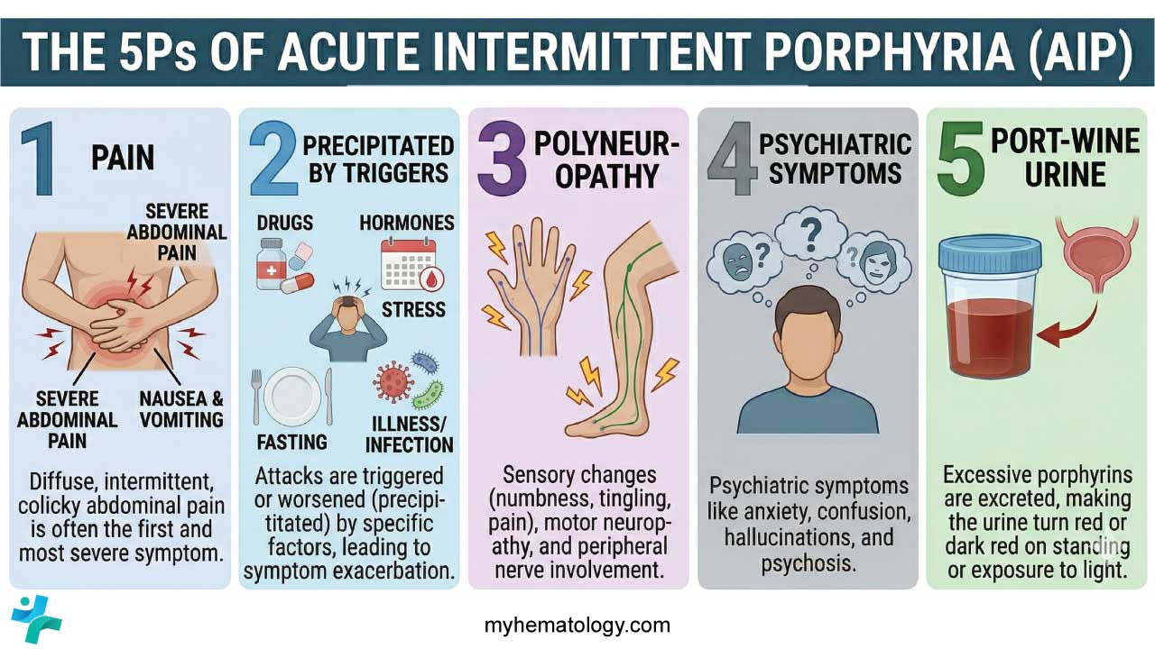 The 5Ps of Acute Intermittent Porphyria identify the multi-systemic manifestations of an acute crisis. The syndrome typically begins with severe, poorly localized Pain (usually abdominal) that is strikingly disproportionate to physical exam findings; Port-wine urine, where the accumulation of porphobilin causes the voided sample to darken to a reddish-brown hue upon exposure to light; Polyneuropathy, characterized by a proximal motor weakness that can potentially progress to life-threatening respiratory failure; Psychological disturbances, ranging from acute anxiety and insomnia to hallucinations or "porphyric madness"; and finally, the fact that these symptoms are Precipitated by specific triggers such as porphyrinogenic drugs, hormonal shifts, or caloric restriction. Together, these signs help clinicians differentiate this "Great Imitator" from common surgical or psychiatric emergencies.