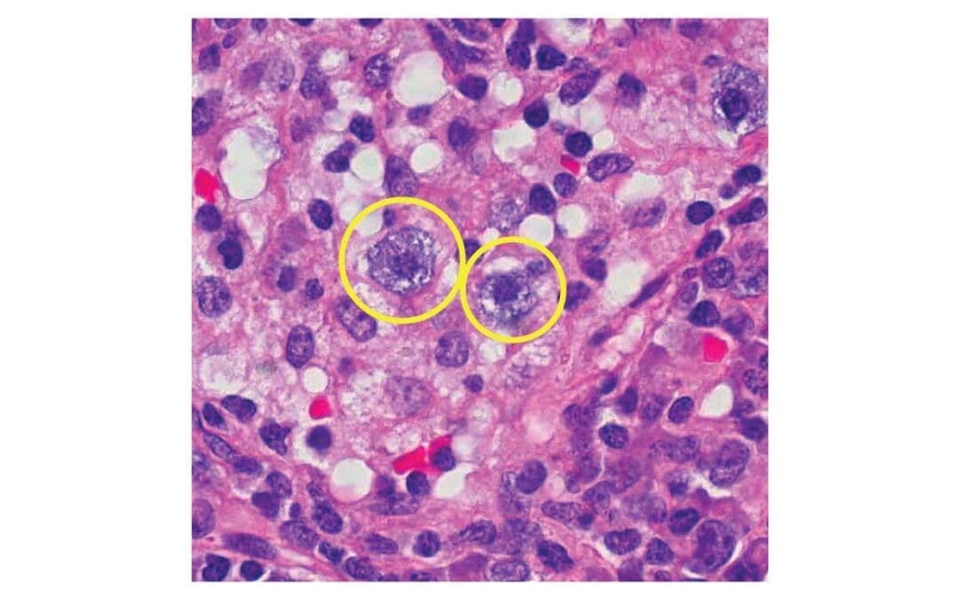 Mast Cell
