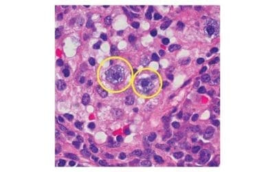 Mast Cell