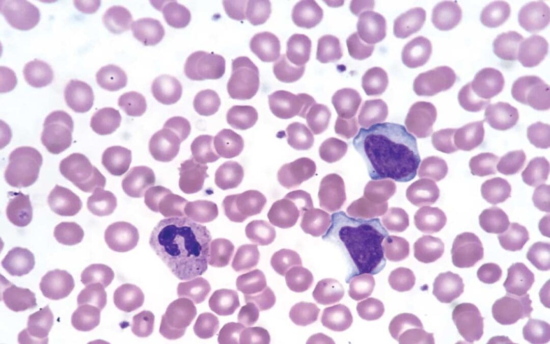 Wright Stain for Peripheral Blood Smear